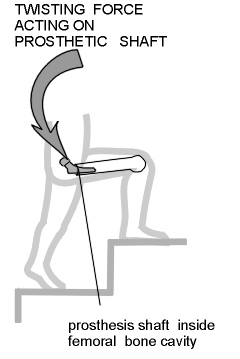 FORCECLIMBINGSTAIR.